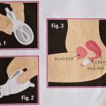 Менструальная чаша или чудо буржуазной фантазии
