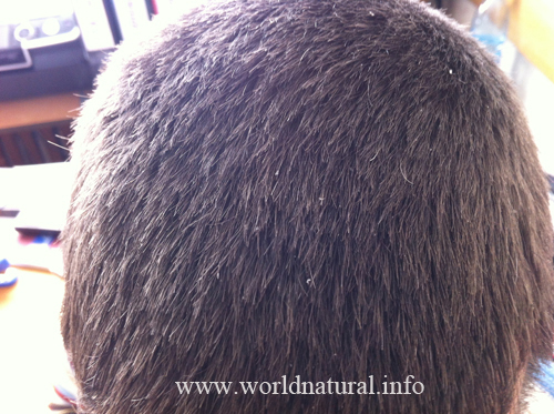 Jason Natural, Dandruff Relief, шампунь от перхоти Jason Natural, Dandruff Relief, шампунь от перхоти