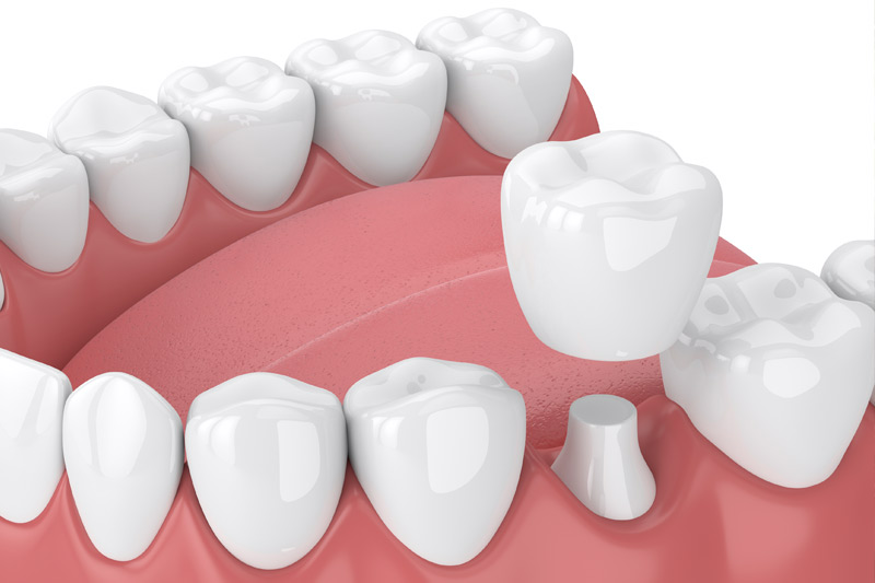 Dentist in San Bernardino